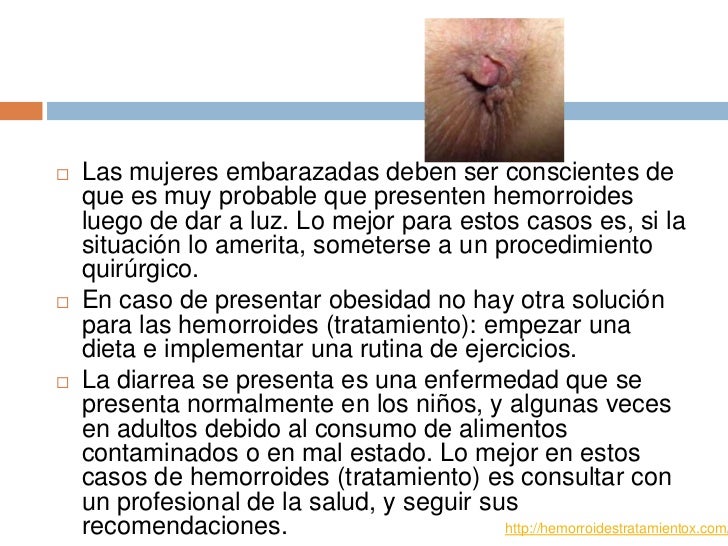 Quitar la inflamación de la vena en el pie por los medios públicos