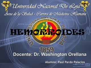 Área de la Salud – Carrera de Medicina Humana
Alumno: Paúl Pardo Palacios
Universidad Nacional De Loja
Docente: Dr. Washington Orellana
HEMORROIDES
 