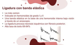 Ligadura con banda elástica
• La más común
• Indicada en hemorroides de grado I y II
• Una banda elástica en la base de una hemorroide interna bajo visión
a través de un anoscopio.
• La ligadura provoca necrosis isquémica con fibrosis posterior.
• Alta tasa de éxito 69-94%
 