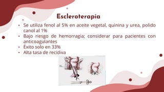 Escleroterapia
• Se utiliza fenol al 5% en aceite vegetal, quinina y urea, polido
canol al 1%
• Bajo riesgo de hemorragia; considerar para pacientes con
anticoagulantes
• Éxito solo en 33%
• Alta tasa de recidiva
 