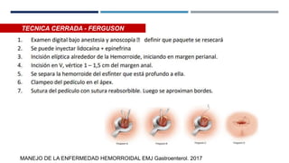 MANEJO DE LA ENFERMEDAD HEMORROIDAL EMJ Gastroenterol. 2017
TECNICA CERRADA - FERGUSON
 