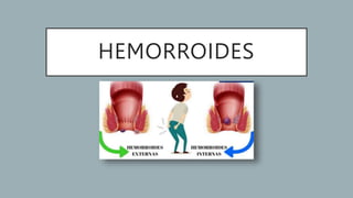 HEMORROIDES
 