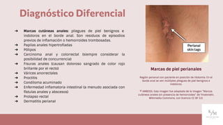 ➔ Marcas cutáneas anales: pliegues de piel benignos e
indoloros en el borde anal. Son residuos de episodios
previos de inﬂamación o hemorroides trombosadas.
➔ Papilas anales hipertroﬁadas
➔ Pólipos
➔ Carcinoma anal y colorrectal (siempre considerar la
posibilidad de concurrencia)
➔ Fisuras anales (causan doloroso sangrado de color rojo
brillante por el recto)
➔ Várices anorrectales
➔ Proctitis
➔ Condiloma acuminado
➔ Enfermedad inﬂamatoria intestinal (a menudo asociada con
fístulas anales y abscesos)
➔ Prolapso rectal
➔ Dermatitis perianal
Diagnóstico Diferencial
Marcas de piel perianales
Región perianal con paciente en posición de litotomía. En el
borde anal se ven múltiples pliegues de piel benignos e
indoloros.
© AMBOSS. Esta imagen fue adaptada de la imagen “Marcos
cutáneos anales sin presencia de hemorroides” de Tmalonetn,
Wikimedia Commons, con licencia CC BY 3.0.
 