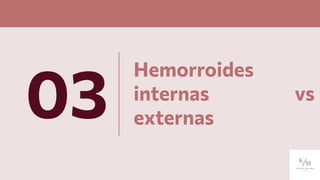 Hemorroides
internas vs
externas
03
 