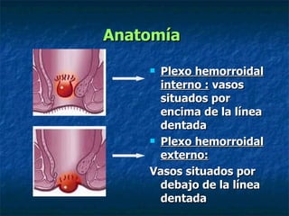 Anatomía   Plexo hemorroidal interno :  vasos situados por encima de la línea dentada  Plexo hemorroidal externo:   Vasos situados por debajo de la línea dentada   