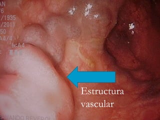 Estructura
vascular
 