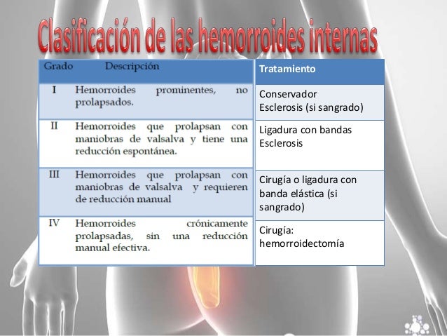 Hemorroides Hemorroides