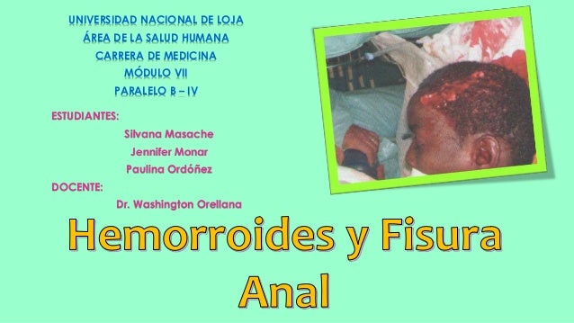 Hemorroides Y Fisura Anal