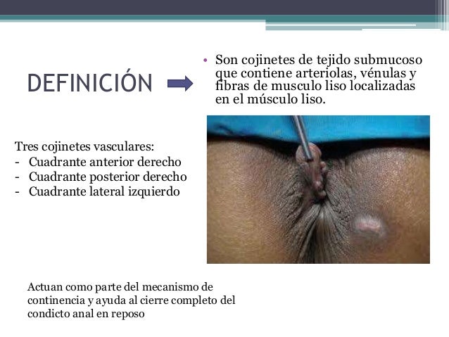 El té contra el alcoholismo