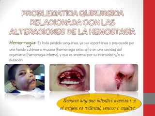 Es toda pérdida sanguínea, ya sea espontánea o provocada por
una herida cutánea o mucosa (hemorragia externa) o en una cavidad del
organismo (hemorragia interna), y que es anormal por su intensidad y/o su
duración.




                                  Siempre hay que intentar precisar si
                                el origen es arterial, venoso o capilar.
 
