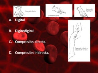 A. Digital.

B. Digitodigital.

C. Compresión directa.

D. Compresión indirecta.
 