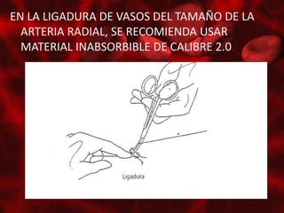 EN LA LIGADURA DE VASOS DEL TAMAÑO DE LA
  ARTERIA RADIAL, SE RECOMIENDA USAR
  MATERIAL INABSORBIBLE DE CALIBRE 2.0
 