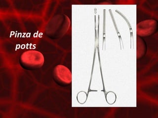 Pinza de
 potts
 
