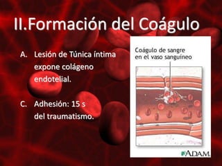 II.Formación del Coágulo
A. Lesión de Túnica íntima
   expone colágeno
   endotelial.

C. Adhesión: 15 s
   del traumatismo.
 