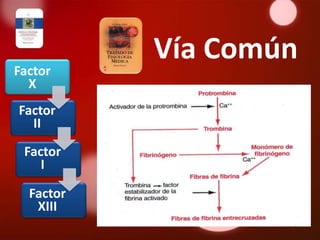 Vía Común
Factor
  X
Factor
  II
 Factor
    I

  Factor
   XIII
 