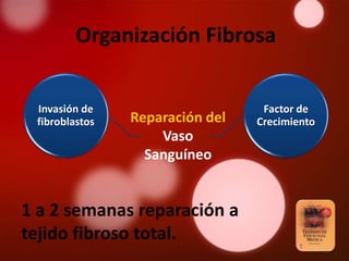 Organización Fibrosa


 Invasión de                      Factor de
 fibroblastos   Reparación del   Crecimiento
                    Vaso
                  Sanguíneo


1 a 2 semanas reparación a
tejido fibroso total.
 