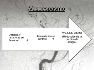 Vasoespasmo
VASOESPASMO
(Reducción de la
perdida de
sangre)
Musculo liso se
contrae 
Arterias y
arteriolas se
lesionan 
 