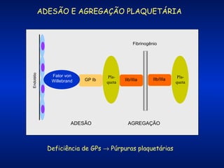 ADESÃO E AGREGAÇÃO PLAQUETÁRIA

Endotélio

Fibrinogênio

Fator von
Willebrand

GP Ib

ADESÃO

Plaqueta

IIb/IIIa

IIb/IIIa

AGREGAÇÃO

Deficiência de GPs → Púrpuras plaquetárias

Plaqueta

 
