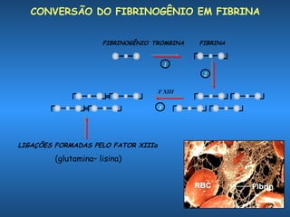 CONVERSÃO DO FIBRINOGÊNIO EM FIBRINA
FIBRINOGÊNIO TROMBINA

FIBRINA

1
2
F XIII
3

LIGAÇÕES FORMADAS PELO FATOR XIIIa

(glutamina– lisina)

 