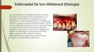 Enfermedad De Von Willebrand (Etiologia)
La enfermedad de von Willebrand (EvW) es el más
frecuente de los trastornos de la...