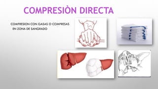 HEMOSTASIA. catedra de cirugia , hemostasia en cirugia | PPT