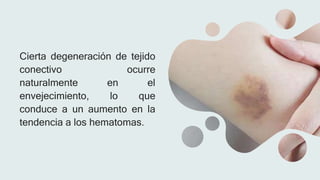 Cierta degeneración de tejido
conectivo ocurre
naturalmente en el
envejecimiento, lo que
conduce a un aumento en la
tendencia a los hematomas.
 