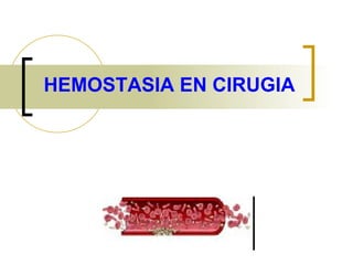 HEMOSTASIA EN CIRUGIA 