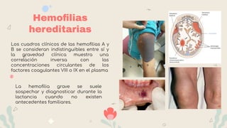 Hemoﬁlias
hereditarias
Los cuadros clínicos de las hemoﬁlias A y
B se consideran indistinguibles entre sí y
la gravedad clínica muestra una
correlación inversa con las
concentraciones circulantes de los
factores coagulantes VIII o IX en el plasma
La hemoﬁlia grave se suele
sospechar y diagnosticar durante la
lactancia cuando no existen
antecedentes familiares.
 