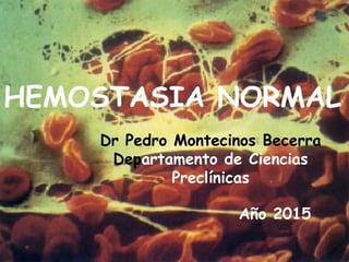 HEMOSTASIA NORMAL
Dr Pedro Montecinos Becerra
Departamento de Ciencias
Preclínicas
Año 2015
 