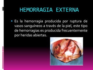 HEMORRAGIA EXTERNA
 Es la hemorragia producida por ruptura de

vasos sanguíneos a través de la piel, este tipo
de hemorragias es producida frecuentemente
por heridas abiertas.

 