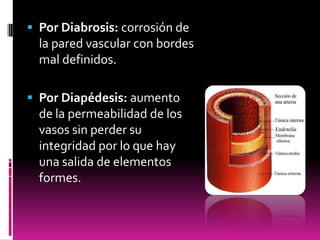  Por Diabrosis: corrosión de

la pared vascular con bordes
mal definidos.
 Por Diapédesis: aumento

de la permeabilidad de los
vasos sin perder su
integridad por lo que hay
una salida de elementos
formes.

 