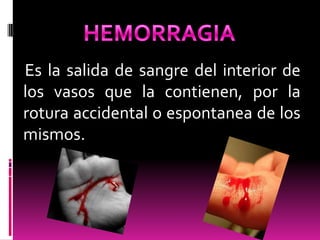 Es la salida de sangre del interior de
los vasos que la contienen, por la
rotura accidental o espontanea de los
mismos.

 