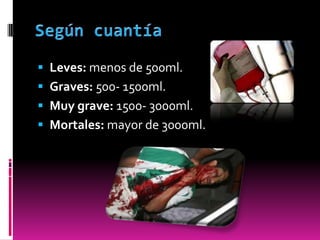  Leves: menos de 500ml.
 Graves: 500- 1500ml.

 Muy grave: 1500- 3000ml.
 Mortales: mayor de 3000ml.

 