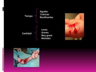 Tiempo

Cantidad

Agudas
Crónicas
Recidivantes

Leves
Graves
Muy grave
Mortales

 
