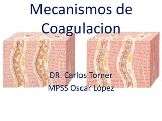 Mecanismos de
Coagulacion
DR. Carlos Torner
MPSS Oscar López
 