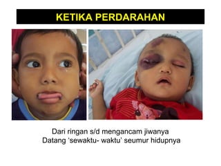 Dari ringan s/d mengancam jiwanya  Datang ‘sewaktu- waktu’ seumur hidupnya KETIKA PERDARAHAN 