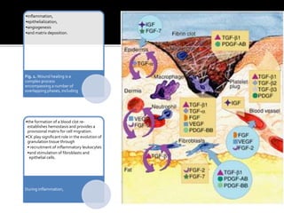 •inflammation,
•epithelialization,
•angiogenesis
•and matrix deposition.
Fig. 1. Wound healing is a
complex process
encompassing a number of
overlapping phases, including
•the formation of a blood clot re-
establishes hemostasis and provides a
provisional matrix for cell migration.
•CK play significant role in the evolution of
granulation tissue through
• recruitment of inflammatory leukocytes
•and stimulation of fibroblasts and
epithelial cells.
During inflammation,
 