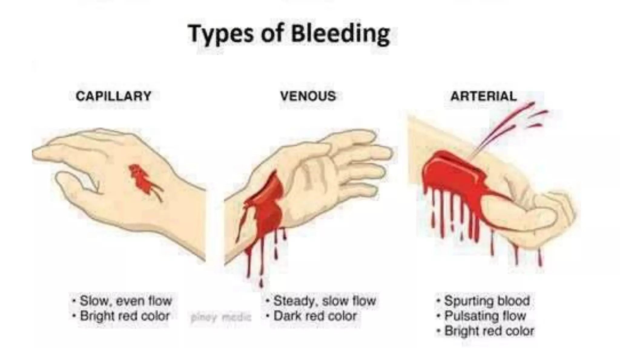 Hemostasis, bleeding, Shock.pptx | Blood Disorders | Diseases and ...