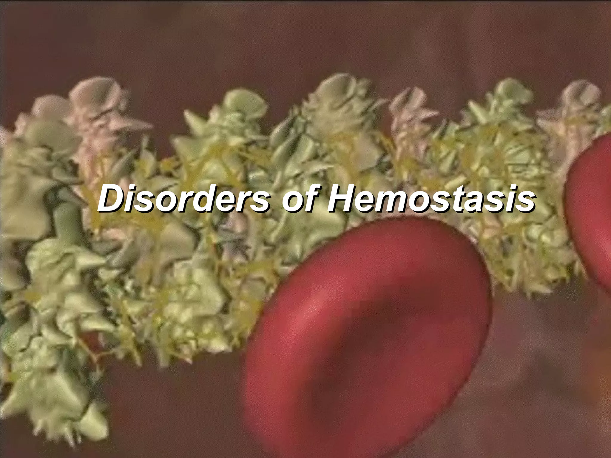 Hemostasis Disorders | PPT