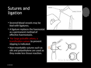 Transfixation Incision hemostasis & mc (1) (1).pptx presentation | PPTX