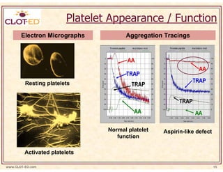 Platelet Appearance / Function
       Electron Micrographs            Aggregation Tracings




         Resting platelets




                                 Normal platelet   Aspirin-like defect
                                    function

         Activated platelets

www.CLOT-ED.com                                                          15
 