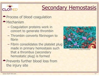 Secondary Hemostasis
    Process of blood coagulation
    Mechanism
     – Coagulation proteins work in
       concert to generate thrombin
     – Thrombin converts fibrinogen to
       fibrin
     – Fibrin consolidates the platelet plug
       made in primary hemostasis such         Credit: Weisel JW. University of Pennsylvannia

       that a thrombus (secondary
       hemostatic plug) is formed
    Prevents further blood loss from
    the injury site

www.CLOT-ED.com                                                                                 17
 