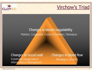 Virchow’s Triad



                           Changes in blood coagulability
                   Platelets, Coagulation Factors & Inhibitors, Fibrinolysis




          Changes in vessel wall                  Changes in blood flow
          Endothelial changes due to                  Rheology in vessels
          inflammation or atherogenesis

www.CLOT-ED.com                                                                4
 