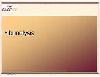Fibrinolysis




www.CLOT-ED.com   49
 