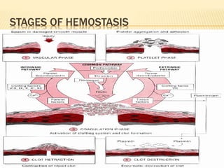 STAGES OF HEMOSTASIS 
 