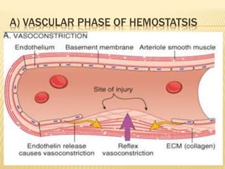 A) VASCULAR PHASE OF HEMOSTATSIS 
 