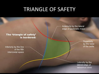 TRIANGLE OF SAFETY
 