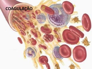 COAGULAÇÃO
 