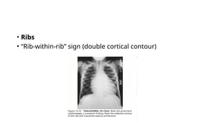 Comprehensive Overview of Hematological and Vascular Bone Diseases ...