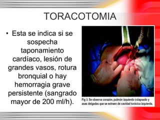 HEMOTORAX ESPONTANEOEs muy infrecuente, puede deberse a rotura de malformaciones como fístulas arteriovenosas pulmonares , en el curso de tratamiento anticoagulante, desordenes de la coagulación o ruptura de aneurismas de aorta.